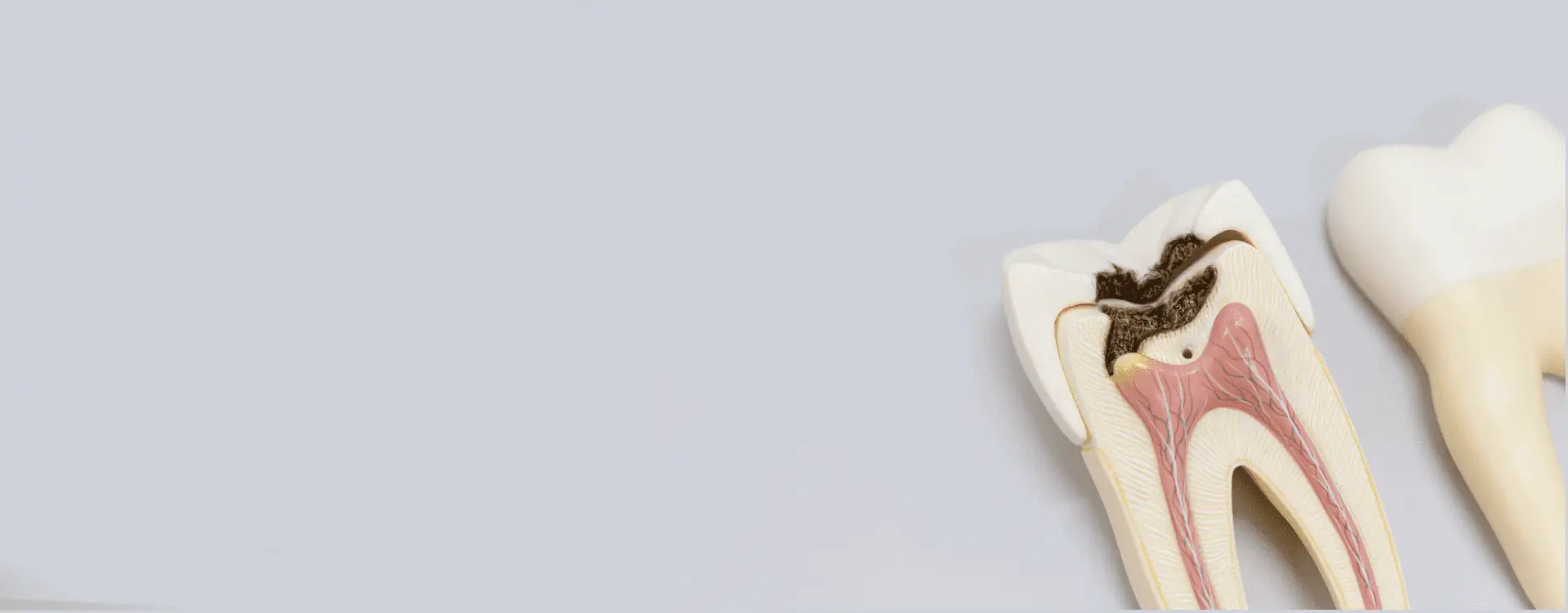 Bild eines Zahnnervs bei der mikroskopischen Endodontie
