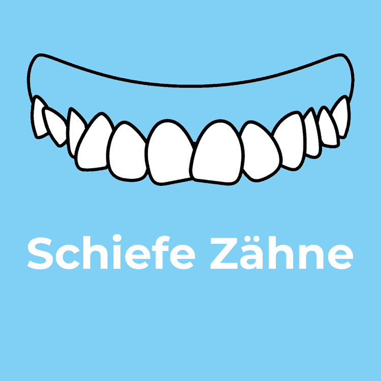 Schiefe Zähne Rodgau - Zahnarztpraxis Dr. Ruscher - Ihr Zahnarzt in Rodgau