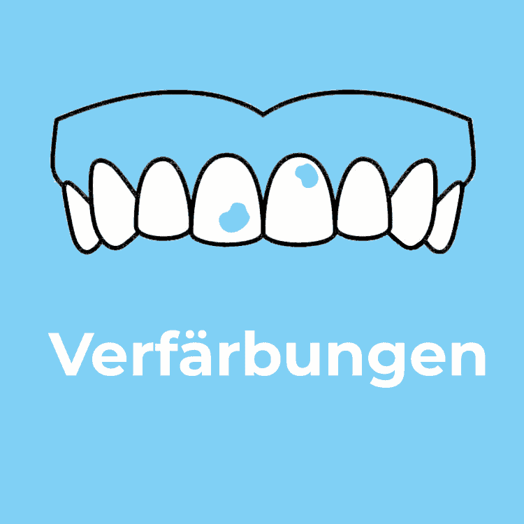 Verfärbte Zähne in Rodgau - Zahnarztpraxis Dr. Ruscher - Ihr Zahnarzt in Rodgau