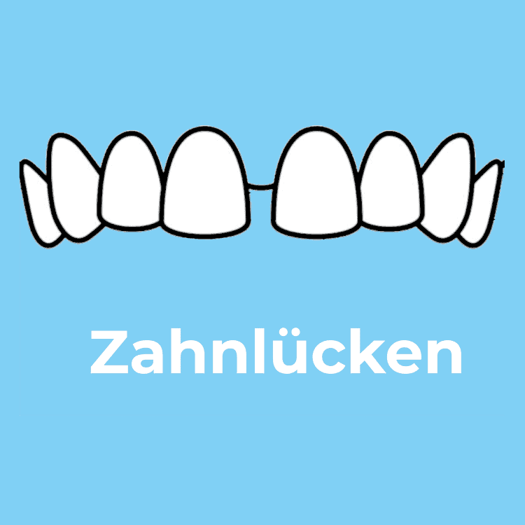 Zahnlücken Rodgau - Zahnarztpraxis Dr. Ruscher - Ihr Zahnarzt in Rodgau