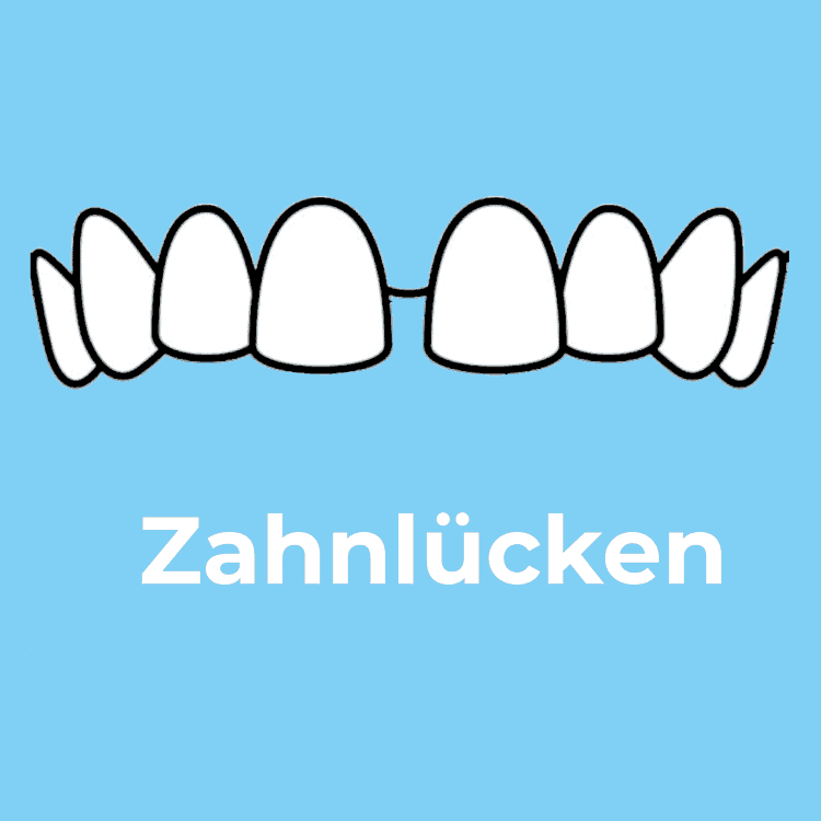 Zahnlücken Rodgau - Zahnarztpraxis Dr. Ruscher - Ihr Zahnarzt in Rodgau